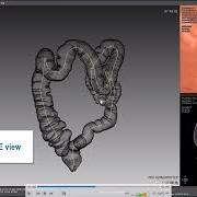 PHẦN MỀM TÁI TẠO HÌNH ẢNH KHUNG ĐẠI TRÀNG MYRIAN XP-COLON