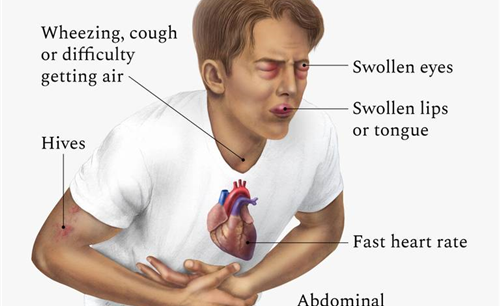 QUÁ MẪN VỚI VACCINE – những điều cần lưu ý