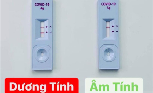 Test nhanh ( xét nghiệm kháng nguyên SARS-CoV 2 ) là gì và dùng khi nào?